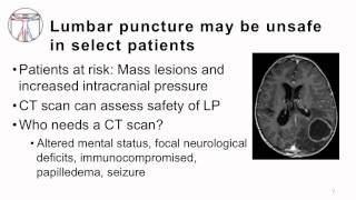 3 Bacterial Meningitis Diagnosis and Common Pathogens [upl. by Nathanil824]