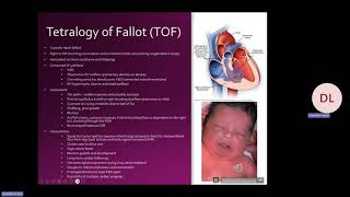 336 Pediatrics Module 8 Cardiovascular Disorders Recording [upl. by Rentsch]