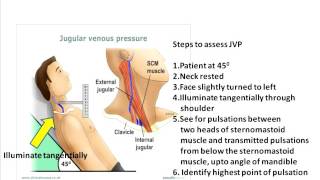 Jugular venous pulse clinical aspects [upl. by Ahseik]