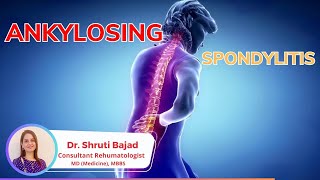 Ankylosing Spondylitis arthritis spine jointpain inflammatory disease flexibility jointpain [upl. by Fleck]