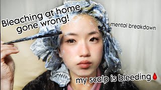 BLEACHING MY HAIR AT HOME WENT HORRIBLY WRONGbleach burnblood scabs and healing [upl. by Slohcin]