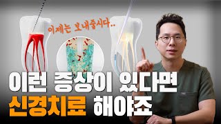 이런 증상이 있다면 신경치료 꼭 해야합니다  신경치료가 필요한 증상 [upl. by Adniram]