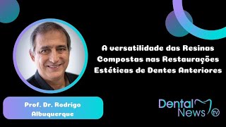 A versatilidade das resinas compostas nas restaurações estéticas de dentes anteriores [upl. by Ahcsrop]