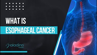 What is Esophageal Cancer  Dr Amit Mathur [upl. by Ailbert]