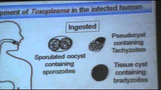 DrAzaa 10  Toxoplasmosis [upl. by Akcimahs]