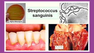 Streptococcus sanguinis [upl. by Jeanna]