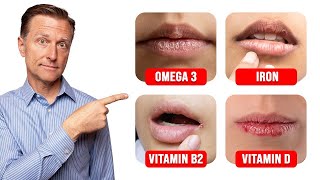 5 Things Your LIPS Can Tell You about Your Nutritional State [upl. by Hemetaf]