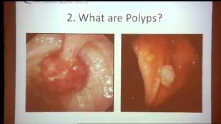 Colorectal Cancer Screening amp Treatment Part 1 of 7 [upl. by Anertak129]