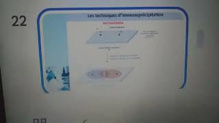 Lelectrosynérèseimmunoélèctrodiffusiontechnique de précipitation🌷Immunologie 3ème année med💊 [upl. by Mathur]