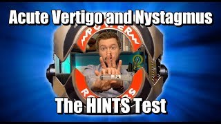 Acute Vertigo and Nystagmus HINTS Test [upl. by Hancock884]