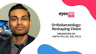 Orthokeratology Reshaping Vision [upl. by Lalitta]