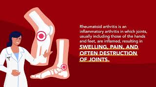 Joint Disorders Rheumatoid Arthritis RA  Merck Manual Consumer Version [upl. by Ellenwad]