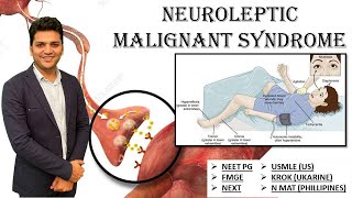 Q21 How Neuroleptic Malignant Syndrome present FMGENEXTUSMLENEETPGMRCPINICETAMC [upl. by Araem]