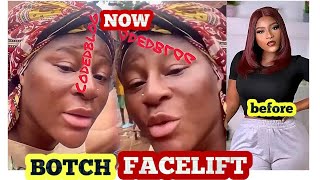 BOTOX WAHALA Destiny Etiko face os getting worse which kind change is this one [upl. by Zanlog]