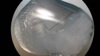 Growing Sodium Thiosulfate Crystals [upl. by Atirma]