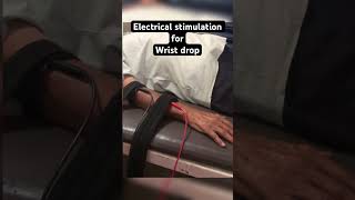 Electrical stimulation for wrist drop shorts physiotherapy [upl. by Nehgaem]