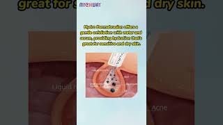 What Can Hydro Dermabrasion Do That Microdermabrasion Can’t mychway hydrodermabrasion [upl. by Harday291]