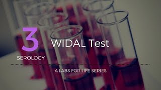 Widal test [upl. by Ecinehs]