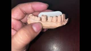 Técnica Bisectriz Odontología [upl. by Aniryt140]