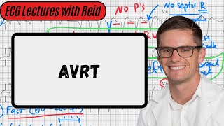 AV Reentry Tachycardia  Day 18 ECG Challenge [upl. by Akenot35]