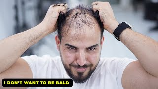 I Dont Want To Be Bald l Thin Hair Transformation by Barber [upl. by Asirrom]