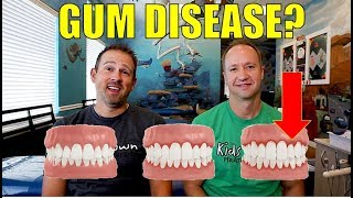 What you NEED to KNOW about GUM DISEASE [upl. by Aicsile]