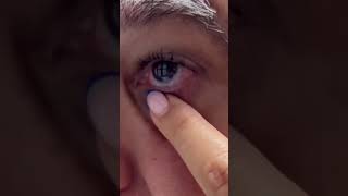 Scleral Lens Insertion and Removal [upl. by Meluhs]