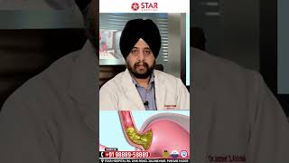 Diffrence Between Hiatus HerniaGERDAcid Reflux in Hindi Hme inme Se Kya Huya Hai kese pta kre [upl. by Redd]