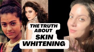 Bollywood Actress Skin Whitening Treatment I Whitening Injection I Whitening Treatment for Skin [upl. by Arlinda]