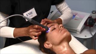 EME  Electroporation treatment with Lift Skin face [upl. by Bridwell977]