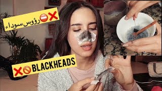 DIY BLACKHEAD peel off Mask ⛔️ DIY إزالة الرؤوس السوداء [upl. by Hasseman]