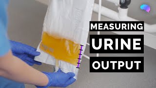 Measuring Urine Output  OSCE Guide  Catheter  UKMLA  CPSA [upl. by Ehman13]