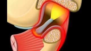 Pain in the Jaw  what you should do [upl. by Ibbison]