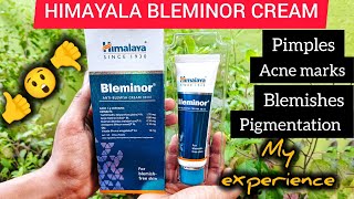 Himalaya Antiblemish cream BLEMINORUses Side effects Honest review 🔥 [upl. by Aysahc]