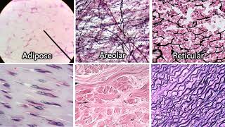 Identifying Connective Tissue  Review and Practice [upl. by Hillman928]