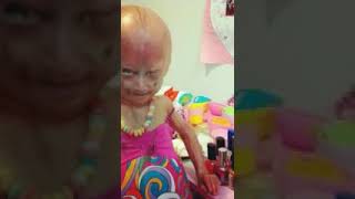 Adalia rose is ugly [upl. by Wrigley]