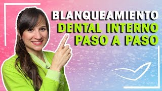 Blanqueamiento Dental Interno Paso a Paso l Protocolo y Cuánto Dura [upl. by Hakkeber434]