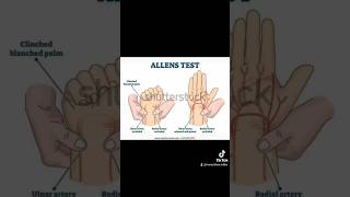 ALLENS TEST TO CHECK RADIAL AND ULNAR ARTERY radial ulnar artery anatomy medical shorts [upl. by Anelim]