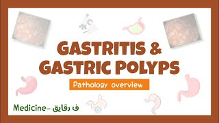 Pathology of the stomach Gastritis amp Gastric polyps  pathology overview GIT surgery عربي [upl. by Marco]