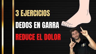 🔥 3 EJERCICIOS PARA DEDOS EN GARRA 🔥 [upl. by Farrah640]