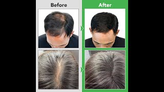 Dok Bua Ku Original Reduce Hair Loss Herbal Shampoo 300ml hairfallsolution dandruff itching [upl. by Nayrda]