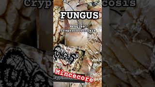 mincecore FUNGUS  MENGIEAL CRYPTOCOCCOSIS mincecore mincecore grindcore crustpunk fungus [upl. by Canute178]