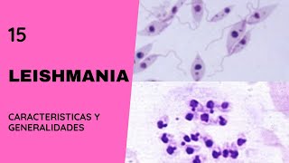 Leishmania 15  Leishmaniasis  Flagelados  Parasitosis [upl. by Ttej]