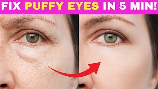 Remove PUFFINESS amp Under EYE BAGS in Minutes [upl. by Rodrique]