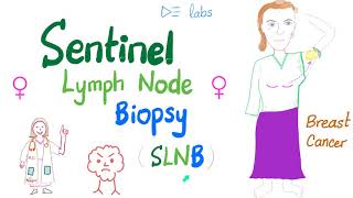 Sentinel Lymph Node Biopsy SLNB for Breast Cancer [upl. by Pascale314]