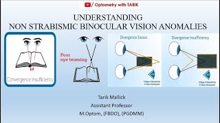 Understanding Non Strabismic Binocular Vision Anomalies [upl. by Ellehsim]