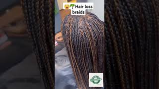 😀🌴Braids on alopecia or hair loss braiding  Dreaducation ideas for dreadlocks [upl. by Grail]