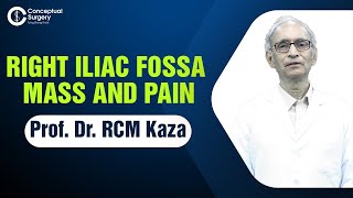 Right Iliac Fossa Mass and Pain by Prof Dr R C M Kaza [upl. by Sheffie39]