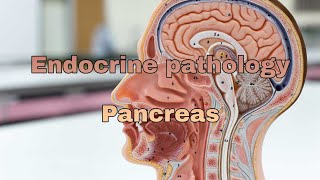 Endocrine pathology lecture Pancreas [upl. by Annahs73]