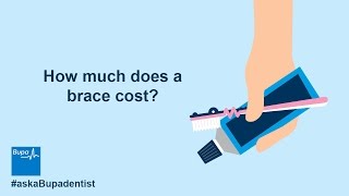 How much does a brace cost [upl. by Phare]